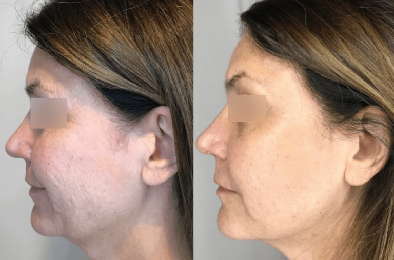 Celebrity Facial Treatments in Oakland County MI | FACE Beauty Science
