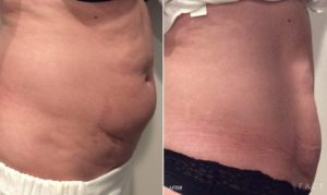 Body Makeover Oakland County MI | FACE Beauty Science
