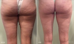 Body Makeover Detroit