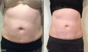 Body Makeover Detroit