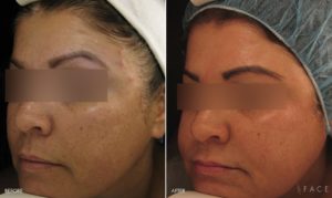 Pigment Results Detroit