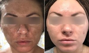 Pigment Results Detroit