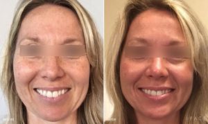 Pigment Results Detroit