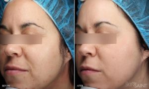 Skin Care Treatments in Oakland County MI | FACE Beauty Science