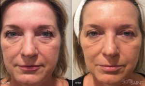 Skin Care Treatments in Oakland County MI | FACE Beauty Science