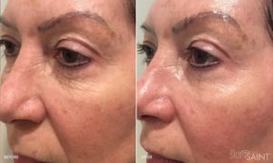 Skin Care Treatments in Oakland County MI | FACE Beauty Science
