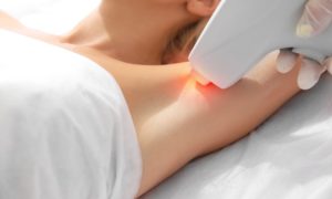 Laser-Hair-Removal-Birmingham