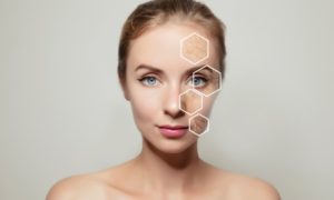 Birmingham Microneedling