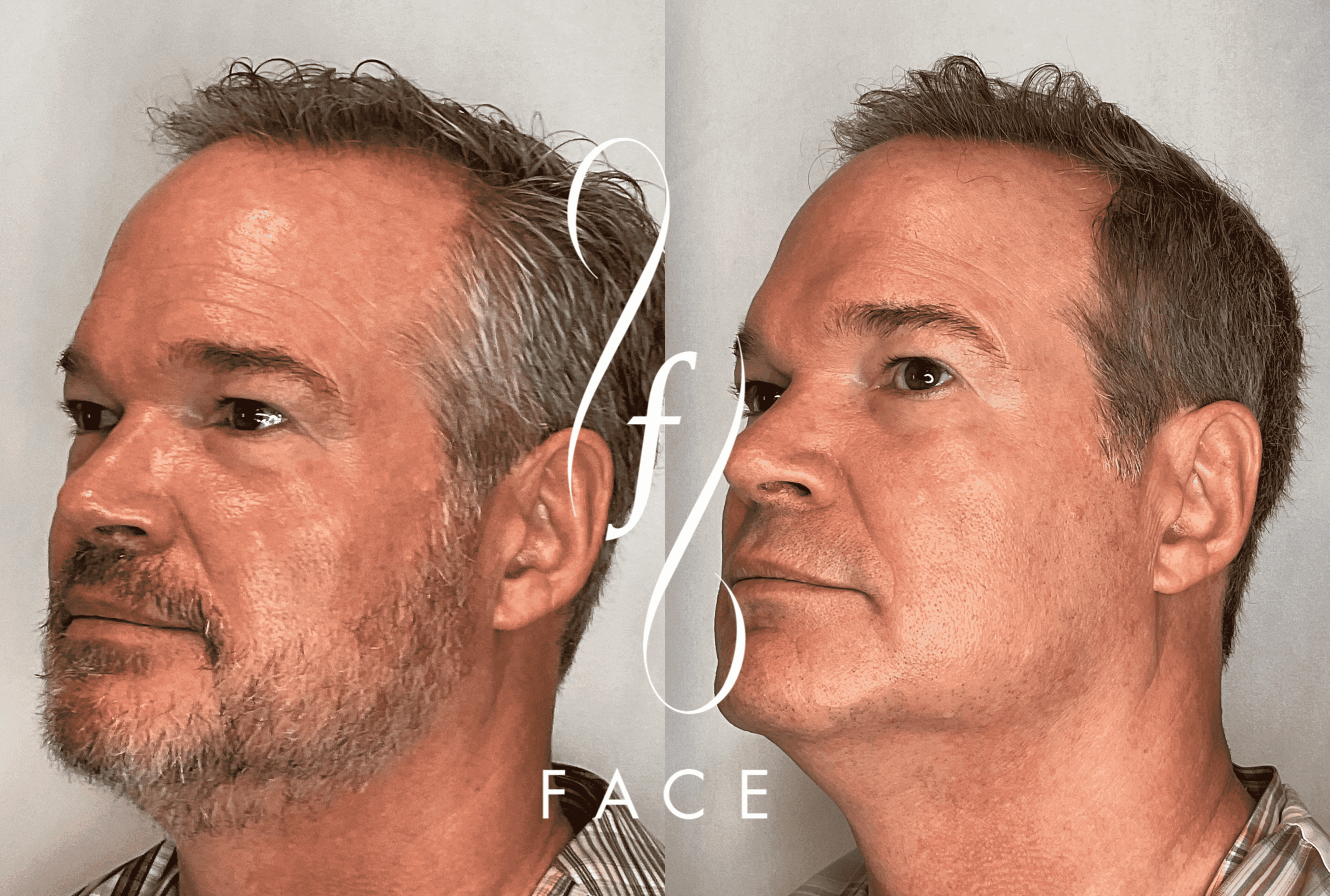 Barney-J-Sylfirm-X_Pearl