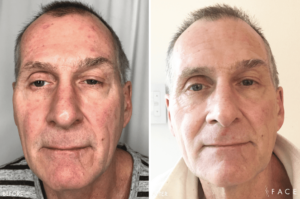 FACE Beauty Science | Oakland County MI