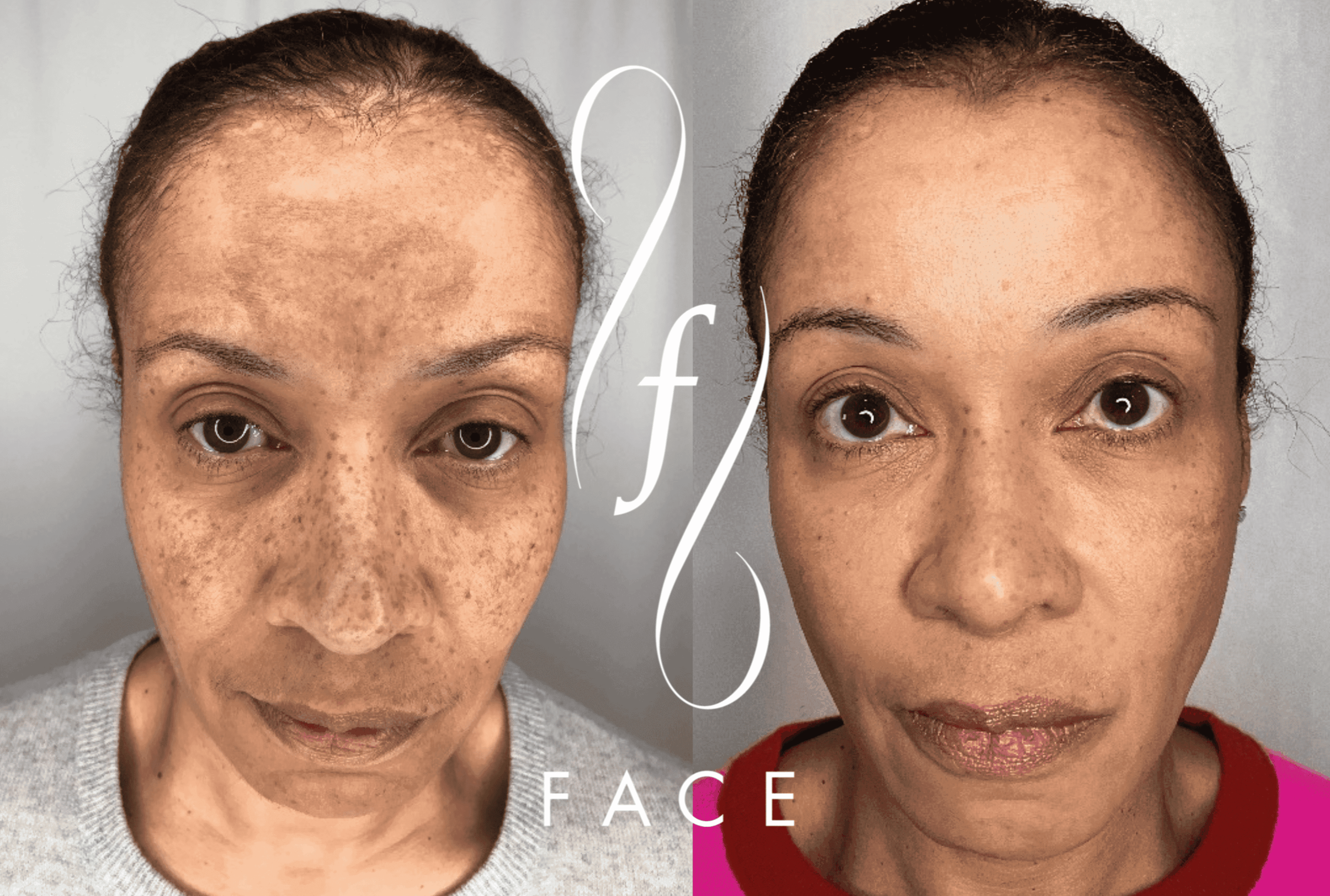 Sylfirm-x-ba-logo-REVA-M-1