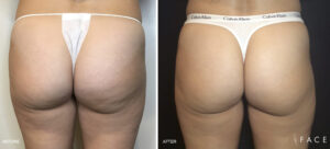 FACE Beauty Science | Oakland County MI