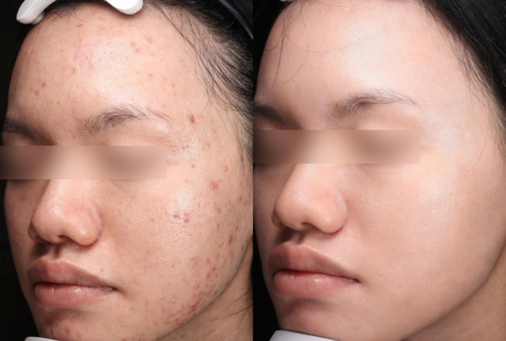 UC COMPANY- ULTRACLEAR BA