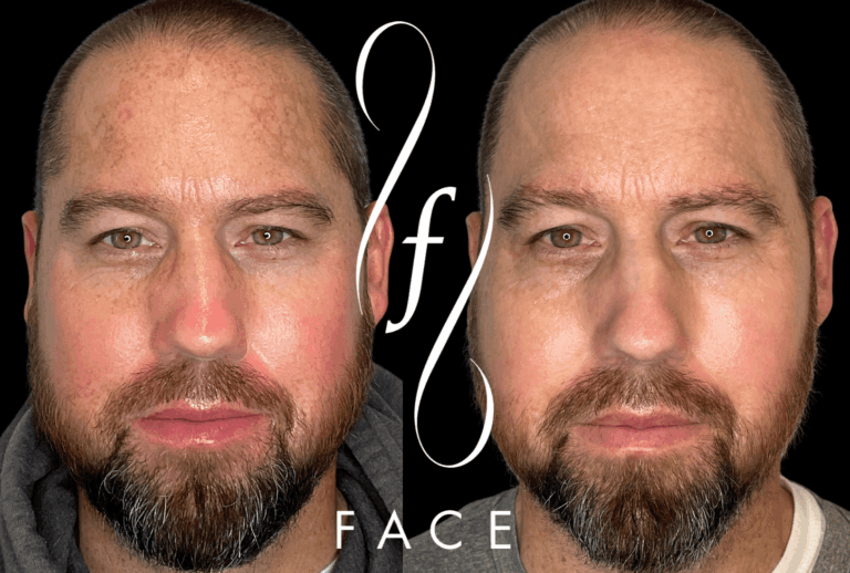 Copy of BEFORE AND AFTERS 2