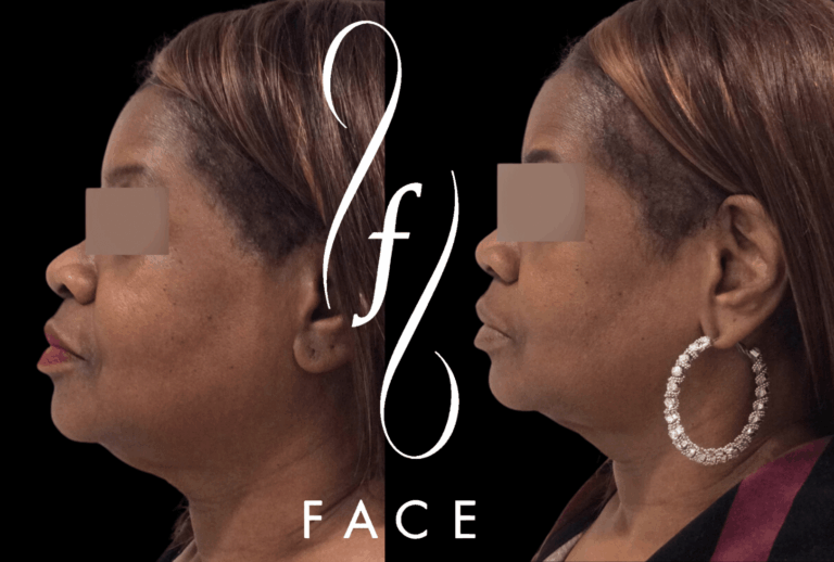 Jewel P. Kybella