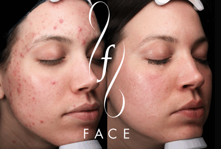 ashley e. acne ba (2)