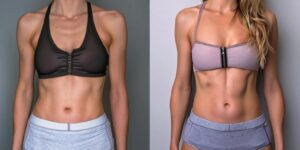 Body Sculpting Results