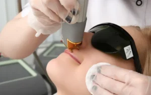 Laser Technology for Texture and Tone Improvements